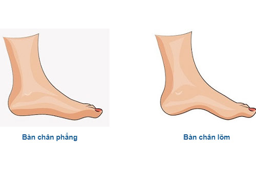 Trắc nghiệm: Hình dáng đôi bàn chân tiết lộ tính cách của bạn