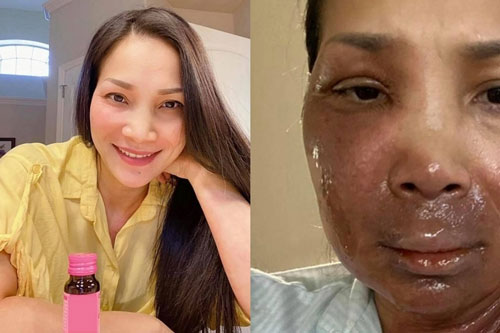 Hồng Ngọc thấy trẻ đẹp hơn sau tai nạn bỏng