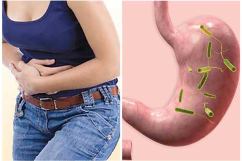 5 "kẻ thù" số 1 của dạ dày, nguy hiểm nhất là cái cuối cùng