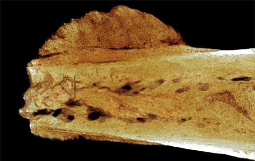 Tế bào ung thư cổ xưa được tìm thấy trong khúc xương 1,7 triệu tuổi - 1