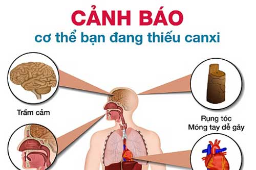 Dấu hiệu cảnh báo cơ thể đang thiếu canxi trầm trọng, cần bổ sung ngay