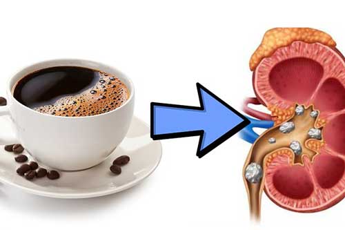 Thói quen vào buổi sáng tưởng vô hại nhưng dễ khiến thận bị tàn phá, tổn thọ