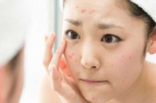 5 thói quen "phá hủy" làn da, tăng tốc độ lão hóa: Điều số 3 chị em nào cũng từng làm