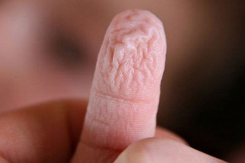 Hóa ra đây là lý do các đầu ngón tay và ngón chân thường nhăn nheo khi ngâm vào nước