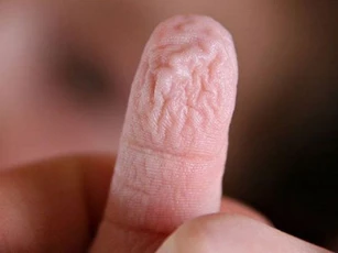 Hóa ra đây là lý do các đầu ngón tay và ngón chân thường nhăn nheo khi ngâm vào nước