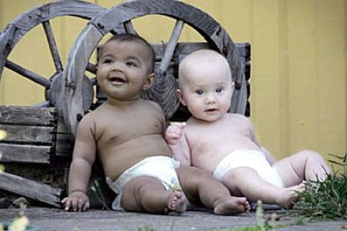Những cặp sinh đôi đặc biệt nhất thế giới