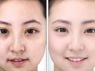 Chỉ với 1 chút đường nâu, bạn đã có thể tẩy sạch các tế bào chết vừa nhanh lại vừa an toàn cho da