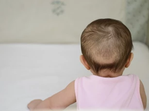Trẻ nhỏ bị rụng tóc vành khăn, mẹ nên làm gì?