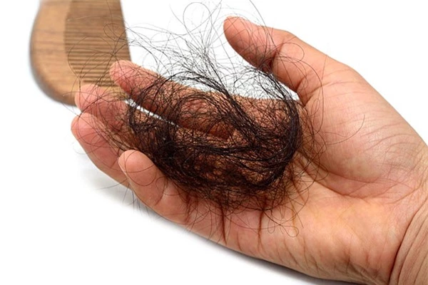 Rụng tóc có thể là dấu hiệu của việc cơ thể đang bị thiếu i-ốt.