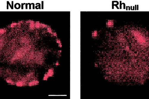 Nhóm máu quý như vàng, cả thế giới chỉ 43 người có