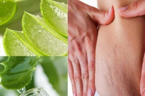 Mẹ bỉm sữa sau sinh nhớ bỏ túi ngay "bí kíp" này xóa tan vết rạn da, bụng phẳng lì chỉ sau 1 tuần