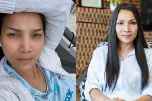 Hồng Ngọc tự tin chụp ảnh cận mặt không trang điểm, khoe làn da phục hồi như chưa từng bị bỏng