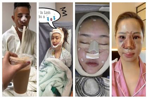 Nhìn hình ảnh những sao Việt này lúc thẩm mĩ khiến công chúng chỉ muốn 'chạy mất dép'