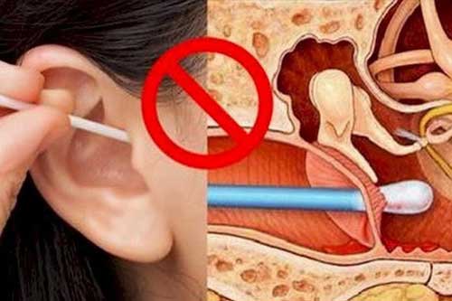Người phụ nữ suýt bị điếc vì thói quen nhiều người Việt mắc phải