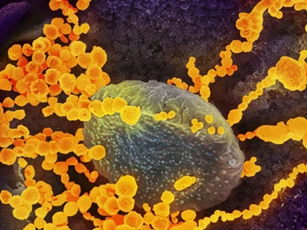 Nghiên cứu mới chứng minh được hiệu quả của thuốc Alpha-Ketoamide 13b trong điều trị COVID-19