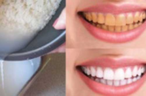 Tạm biệt răng xỉn màu, lấy lại hàm răng trắng sáng bằng thứ nước nhà nào cũng có
