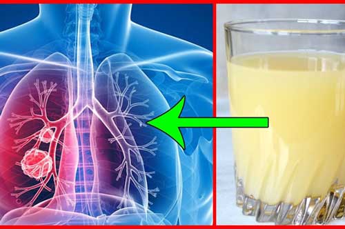 6 thực phẩm "độc" chẳng kém gì thuốc lá, gây nguy hại cho phổi, chớ dại mà nạp vào người