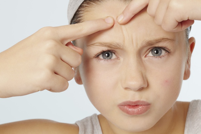 6 cách để mụn xẹp nhanh chóng