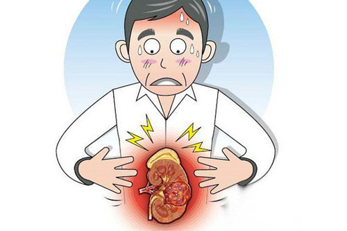 Ung thư thận - Bệnh gặp nhiều ở nam giới