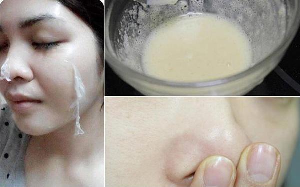 Đắp mặt nạ cả năm mụn đầu đen vẫn đeo bám, bạn phải cho thêm 1 muỗng thứ này