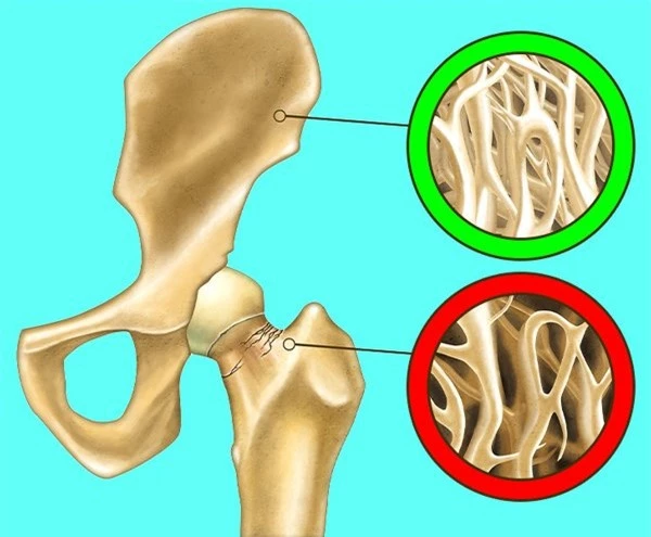 Pha sữa với thứ này uống mỗi ngày cả đời không phải uống thuốc, &#34;tiêu diệt&#34; cả khối u - 6