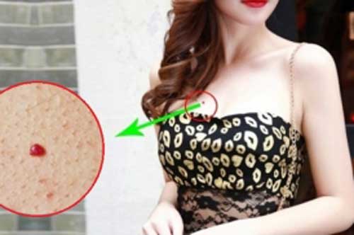 Bật mí 4 vị trí nốt ruồi son dự báo chủ nhân là người được Thần Tài "chiếu cố", tài vận may mắn