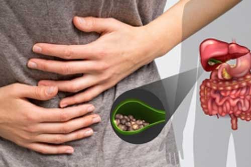 "Chỉ mặt" 3 kiểu ăn uống dễ hình thành sỏi mật: Người Việt mắc cả 3, nên biết sớm để thay đổi