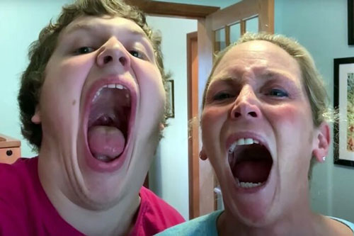 Thiếu niên phá kỷ lục miệng rộng nhất thế giới