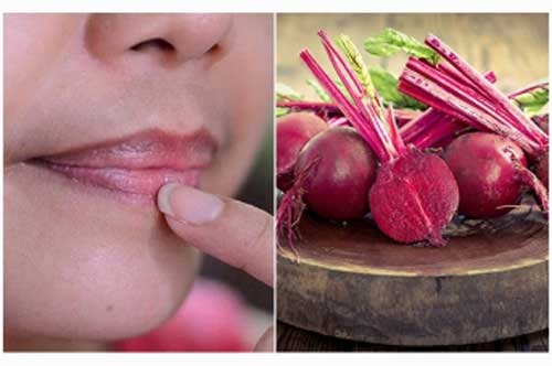 Trị thâm môi "trong vòng 1 nốt nhạc" với nước ép củ dền, bạn đã thử chưa?