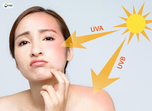 Bí kíp đơn giản giúp da chống nắng hiệu quả ngày hè