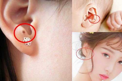 Phụ nữ sở hữu 4 nốt ruồi “quý nhân”, cả cuộc đời có thể sống trong nhung lụa, giàu sang hơn người