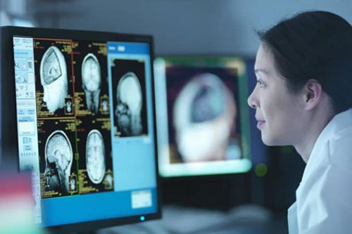 Nghiên cứu chấn động: Não vẫn hoạt động sau khi con người chết đi