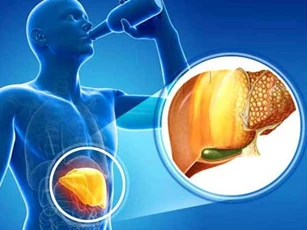 Dấu hiệu cảnh báo gan nhiễm mỡ nặng, nhanh chóng đi khám ngay còn kịp