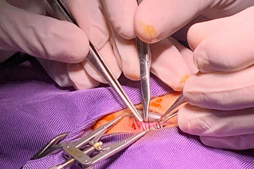 Lác mắt bẩm sinh ở trẻ - bệnh cần được điều trị sớm