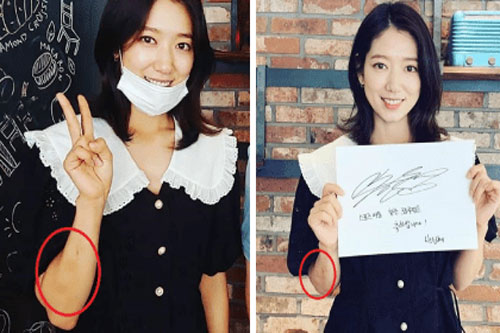 Park Shin Hye gầy đi trông thấy, tay xuất hiện nhiều vết bầm tím