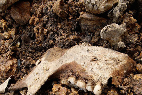 Phát hiện cả nghìn răng người giấu trong bức tường nhà ở Mỹ