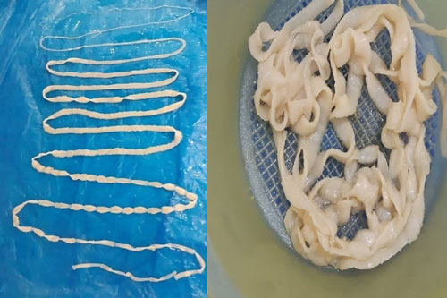 Thường xuyên ăn bò tái, bò nhúng người đàn ông xổ ra con sán dây dài 3m