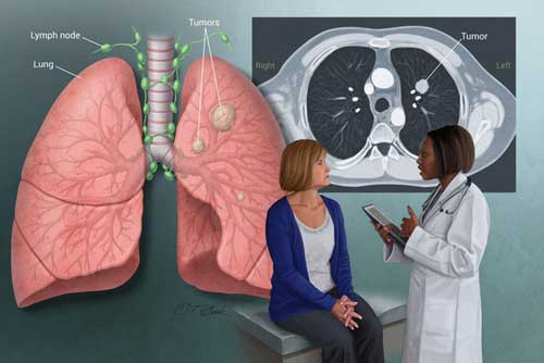 Muốn ngừa ung thư nhất định phải làm 3 việc đơn giản này nhưng nhiều người thường biết quá muộn