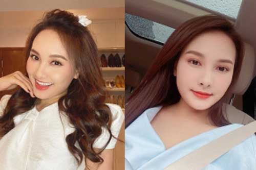 Bảo Thanh vướng nghi vấn tiêm filter khi lộ gương mặt bỗng dưng sưng vù khác lạ