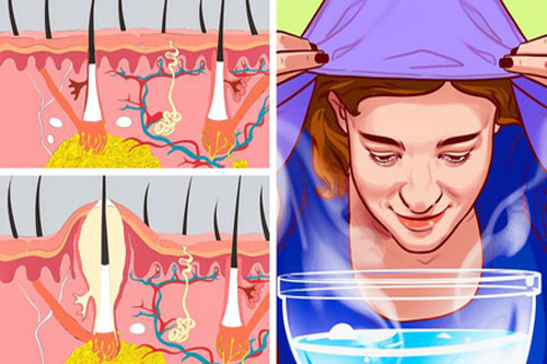 Lợi ích khi xông hơi da mặt mỗi tuần