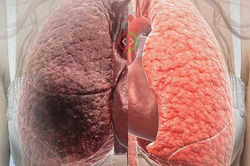 5 thực phẩm "thần thánh" thanh lọc phổi đặc biệt hiệu quả, dù với người hút thuốc lá bao năm