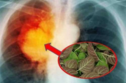 Dùng 1 nắm lá mơ lông, phổi viêm trắng phếu cũng khỏi sau 1 tuần, hiệu quả khiến ai cũng bất ngờ
