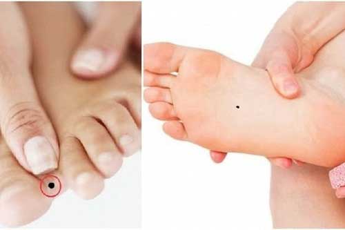 Phụ nữ sở hữu nốt ruồi ở vùng "cực độc" này, cả đời dễ "ngồi trên đống vàng", đếm tiền mỏi tay