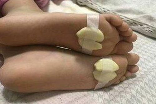 Trước khi ngủ đặt 2 lát tỏi dưới lòng bàn chân, bạn sẽ 'sốc' với kết quả thu được