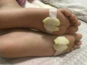 Trước khi ngủ đặt 2 lát tỏi dưới lòng bàn chân, bạn sẽ 'sốc' với kết quả thu được