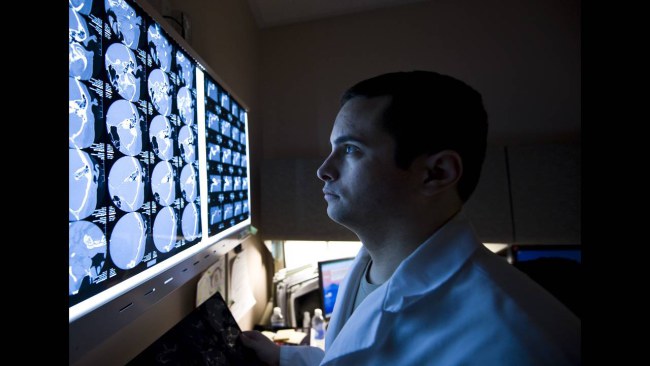 Não của phụ nữ lão hóa chậm hơn đàn ông