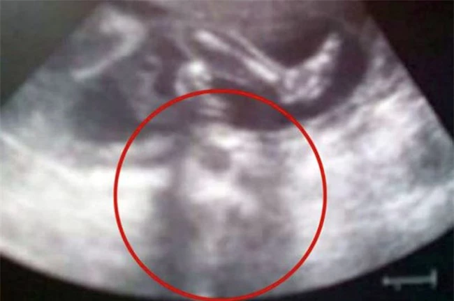 Những hình ảnh siêu âm thai khiến người xem ‘lạnh gáy’ - 7