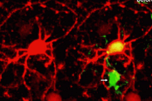 Tế bào não bộ dọn 'rác thải' trong hệ thần kinh như thế nào?