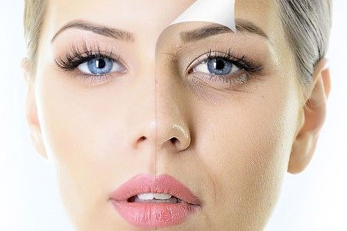 Mẹo xóa tan quầng thâm và bọng mắt chỉ với 2 nguyên liệu trong nhà bếp