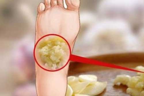 Chuyên gia Đông y chia sẻ: Trước khi đi ngủ đắp hai tép tỏi vào lòng bàn chân, điều kỳ diệu xảy ra